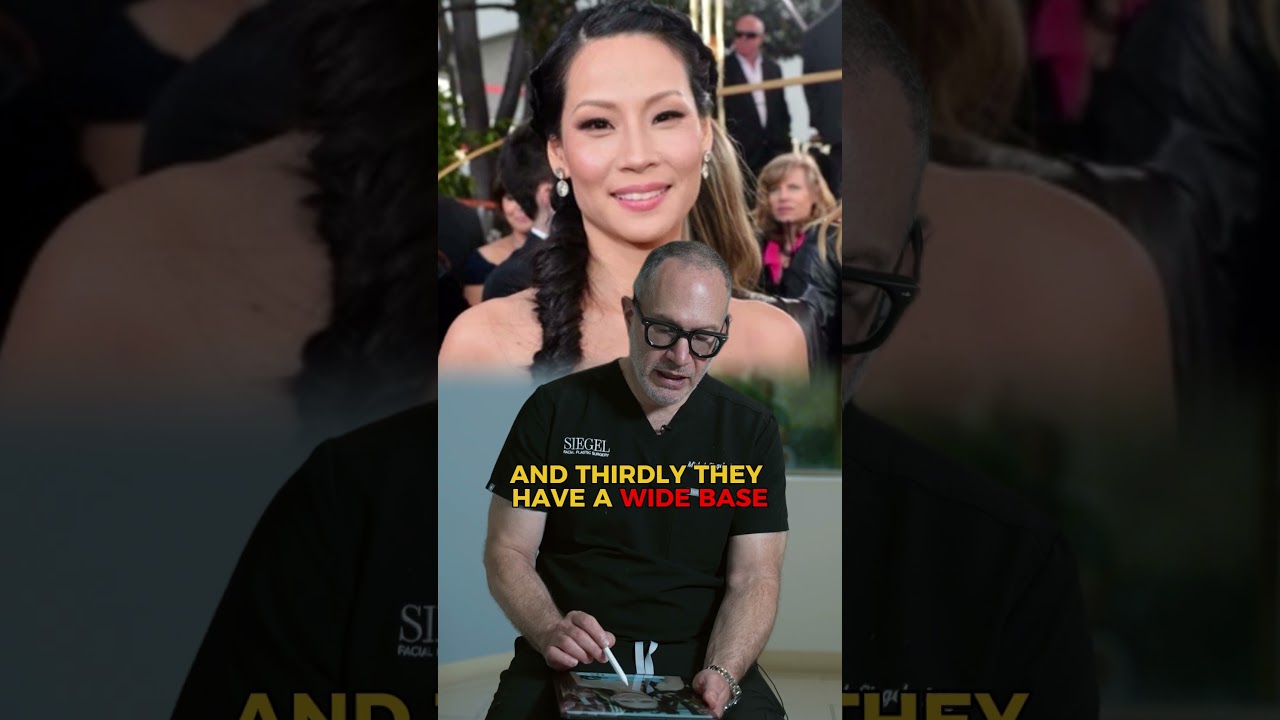 East Asian Nose Explained: Bridge, Tip, and Common Rhinoplasty Goals | Dr. Siegel Breaks It Down