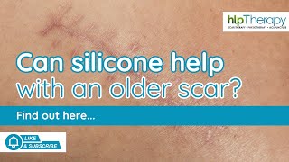 🤔 Can I Use Silicone on an Older Scar? | Hannah from HLP Therapy Explains