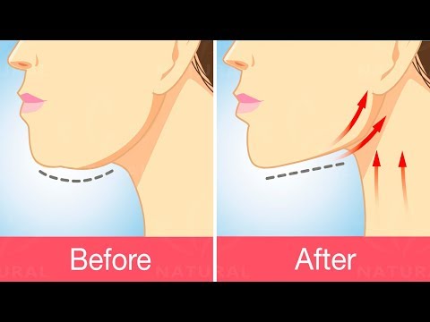 Get Rid of Double Chins With This Exercise and Natural Treatment