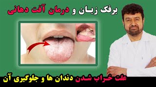 درمان برفک زبان چیست | درمان آفت دهانی چیست | علت خراب شدن دندان ها چیست و تداوی آن چیست ? داکترستان