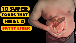 Top 10 SUPER FOODS That Can Heal A FATTY LIVER