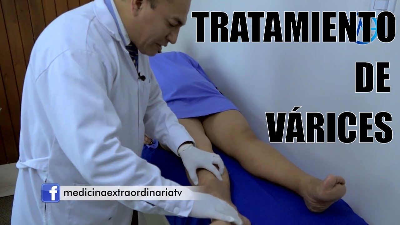 recomandari în perioada postoperatorie în varicoza