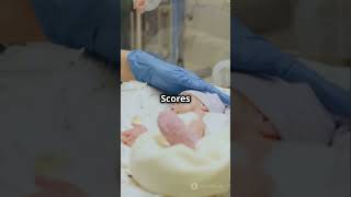 Apgar Scoring Explained In 60 Seconds