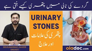 Gurday Ki Nali Me Pathri Ka Ilaj - Urinary Stones Symptoms In Urdu- Gurde Mein Pathri Kaise Hoti Hai