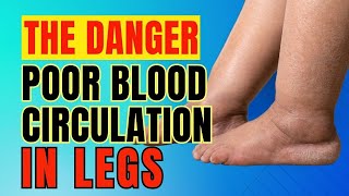 Don't Ignore These 14 warning signs of Poor Circulation in Legs-They Trying to Tell You Something!!