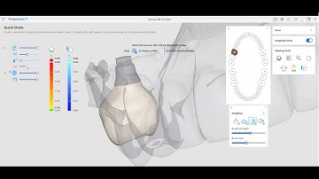 [2023] R2Gate Screw Retained Provisionals with Medit Temporaries