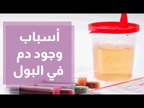 فيديو: لماذا الكلب يحتاج Furosimide؟