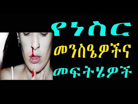 Ethiopia: Epistaxis, Nasal bleeding, የነስር መንስዔዎችና መፍትሄዎች