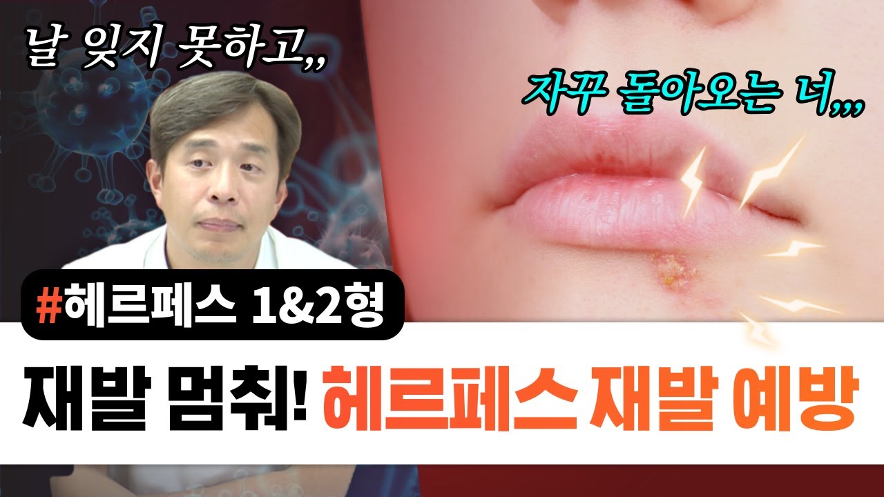 재발 멈춰! 헤르페스 재발 방지하기 - 서울대 전문의 - YouTube