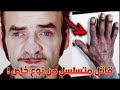 أربع نساء شق ة واحدة ورعب لا ي صد ق في هامبورغ فريتس هونكا أخطر قاتل متسلسل 