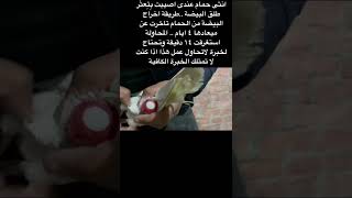 طريقة اطلاق بيضة من حمامة متعسرة #pigeon #الحمامة #امراض_الحمام