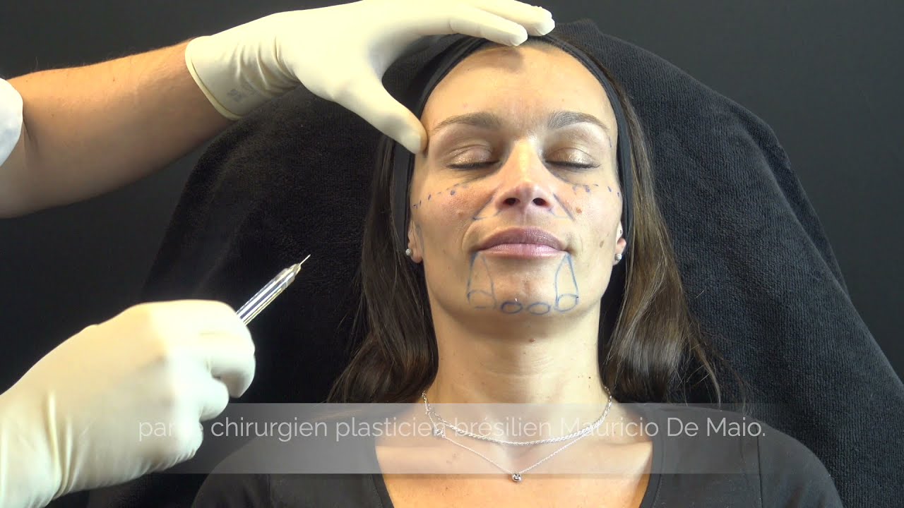 Injections Acide Hyaluronique au visage - Médecine Esthétique- Clinic Renaissance