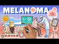 ¿Qué es el melanoma?