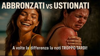 Abbronzati Vs Ustionati Una Buona Abbronzatura Al Posto Di Una Cottura.