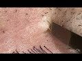 【Plucking facial hair】ずっと見ていられる朱雀のヒゲ抜き 2024.5.31(頬ヒゲ抜き)【Pull out the beard】