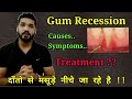 Gum recession, Causes, symptoms, treatment | How to identify receeding gums?