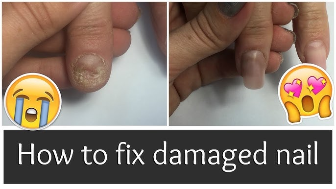 HOW TO REPAIR AND GROW WEAK & DAMAGED NAILS AFTER ACRYLICS 