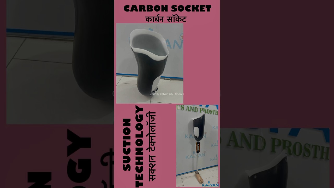 Above knee artificial leg carbon socket || Suction technology || Double wall socket ||