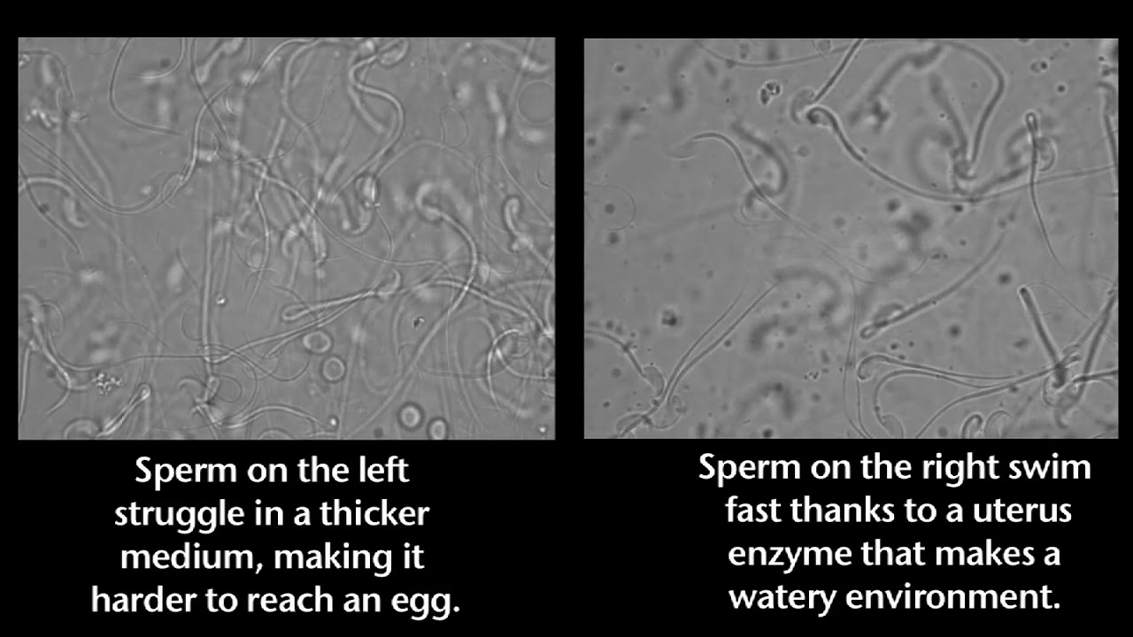 Fertility can hinge on uterus swimming conditions YouTube