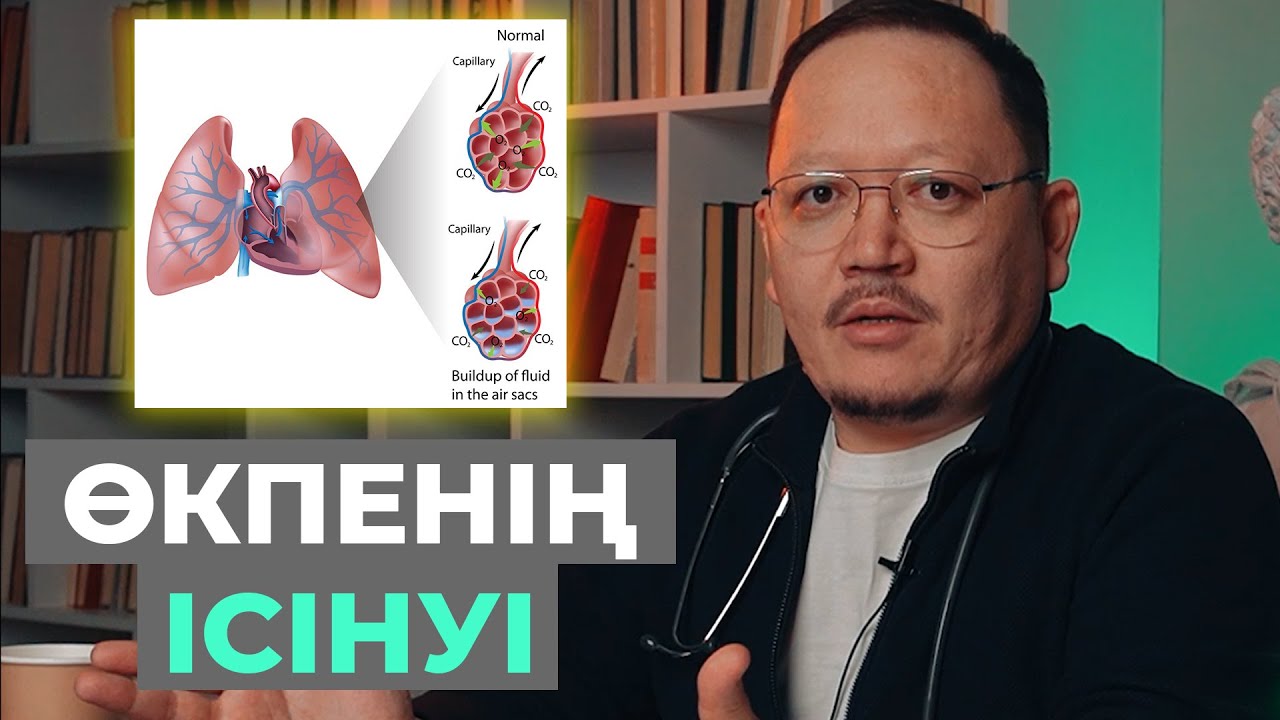 Өкпенің ісінуі! Өкпеге су жиналу белгілері!  Қалай емделеміз?