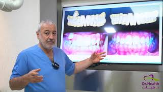 نظام الانسيغنيا لتقويم الاسنان مع دكتور نضال داغستاني