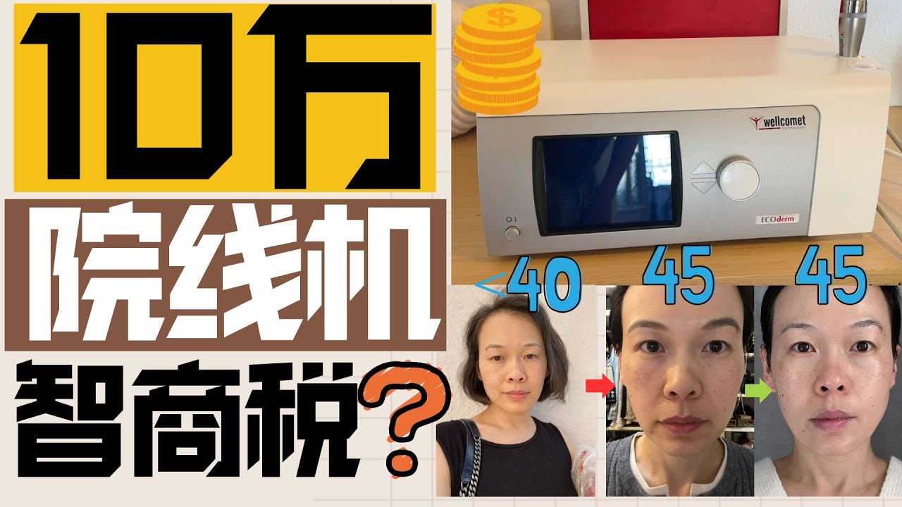 一颱10萬巨貴美容儀是智商稅？做過醫美？前後對比！ 這3個年齡恐現「斷崖式」衰老|🔥你不知道的德国🇩🇪小衆尖貨|skinova和熱瑪吉區別|Skinova和超聲刀區別| 