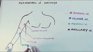Common locations for peripheral nerve injury in the arm