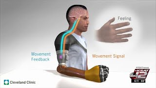 Restoring Touch for Amputees: Sci-Fi Becomes Reality