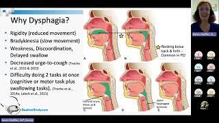 Parkinson's and Dysphagia - Karen Sheffler, SLP - Aug. 8, 2023