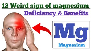 Benefits/functions of magnesium and 12 weird sign of magnesium deficiency