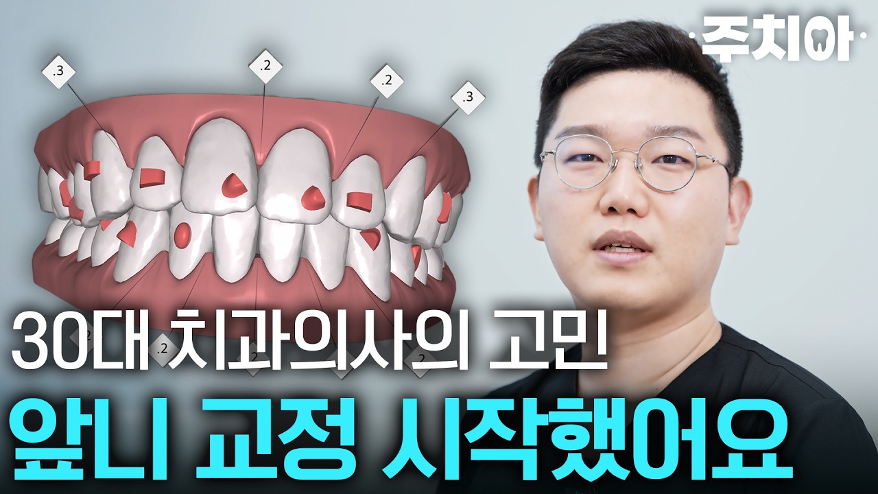 치과의사가 앞니 교정을 30대에 시작하게 된 사연 | 주치아 앞선tube
