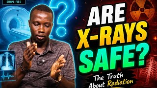 Are X-Rays REALLY Safe? The Truth About Radiation. #RadiologySimplified#XRay#Radiology#Radiation