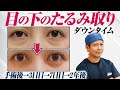 【症例解説】目の下のたるみ取り ダウンタイム経過解説 【40代、50代必見】