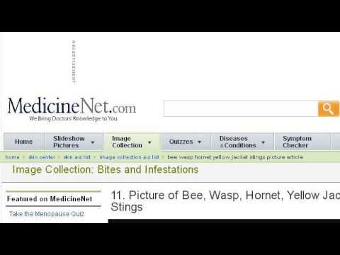 camera iphone 8 plus apk Yellow Jacket Bee Stings On Puppies