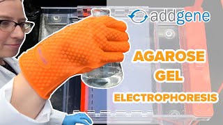 Agarose Gel Electrophoresis