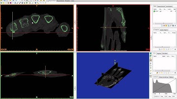 Learn how to create masks in MIMICS 13