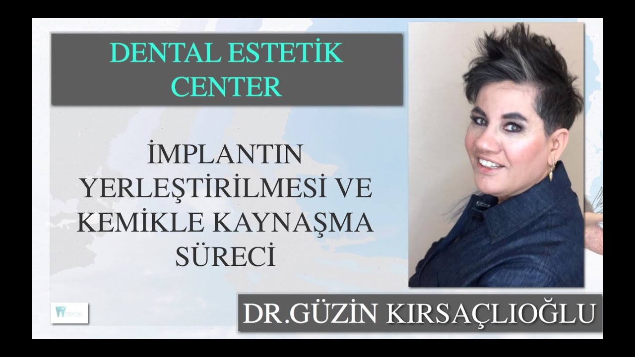 İmplantın Yerleştirilmesi ve Kemikle Kaynaşma Süreci