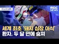 세계 최초 '돼지 심장 이식' 환자, 두 달 만에 숨져