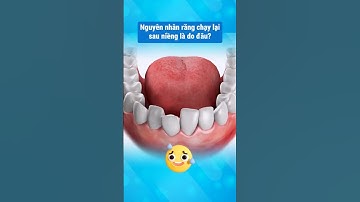 Sau tháo niềng cần chú ý nha các bạn ơi #nhakhoathuyduc #niengrang