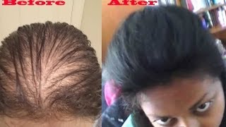 how to make thin hair look thicker using hair pieces