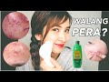 paano mawala ang pimples kahit walang pera o budget?