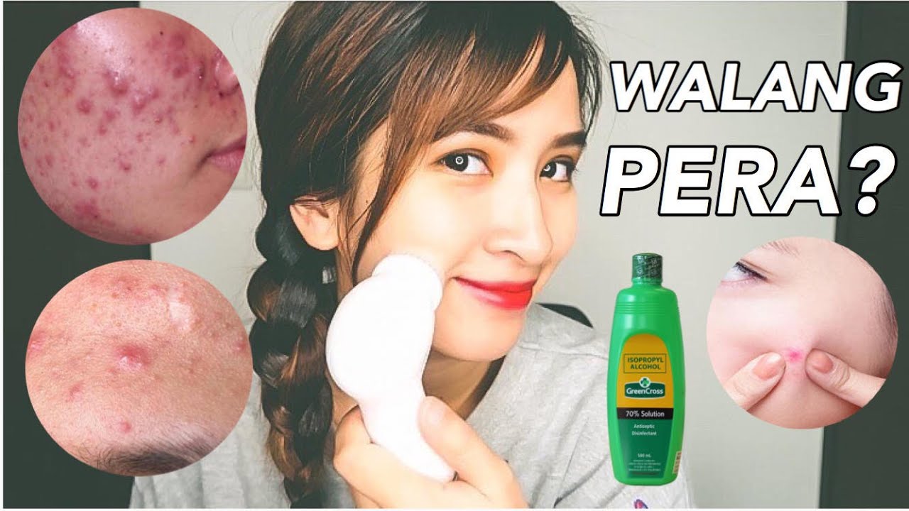 Paano Mawala Ang Pimples At Dark Spot - ayupaano