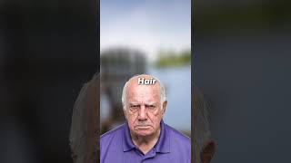 What happens if you start balding ? 😮 [EXPLAINED]