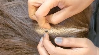 Download Lagu ASMR - Soft \u0026 Soothing Scalp Check \u0026 Treatment 🌿✨ MP3
