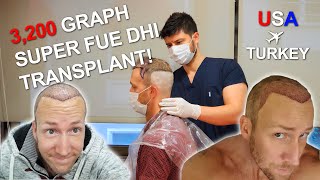 2020 FUE DHI 3200 Graft Hair Transplant From US to Turkey Dr  Cinik PART 1