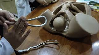 FORCEPS DELIVERY demonstration on DUMMY easy way to go 2 screenshot 2