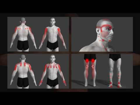 trigger point uitleg animatie (Dutch)