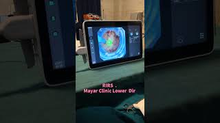 #kidneystone #urologist #pcnl #foryou #surgeon #fylp