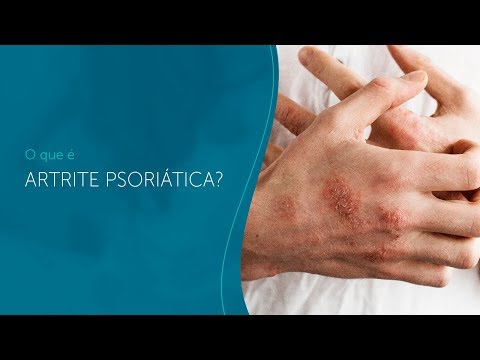 Vídeo: Imagens Dos Sintomas Da Artrite Psoriática