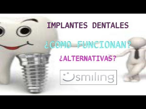 Vídeo: La Era De Los Implantes: Lo Irremplazable Que Es Una Persona - Vista Alternativa